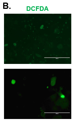 CYP2E1 Expression in Normal and Diseased PHHs. (A) Staining for CYP2E1 (red) expression and DAPI (Blue) with the merged image shown (blue and red) on day 15. (B) ROS expression in Normal (top row) and Diseased (bottom row) PHHs in the hTCS on day 3.