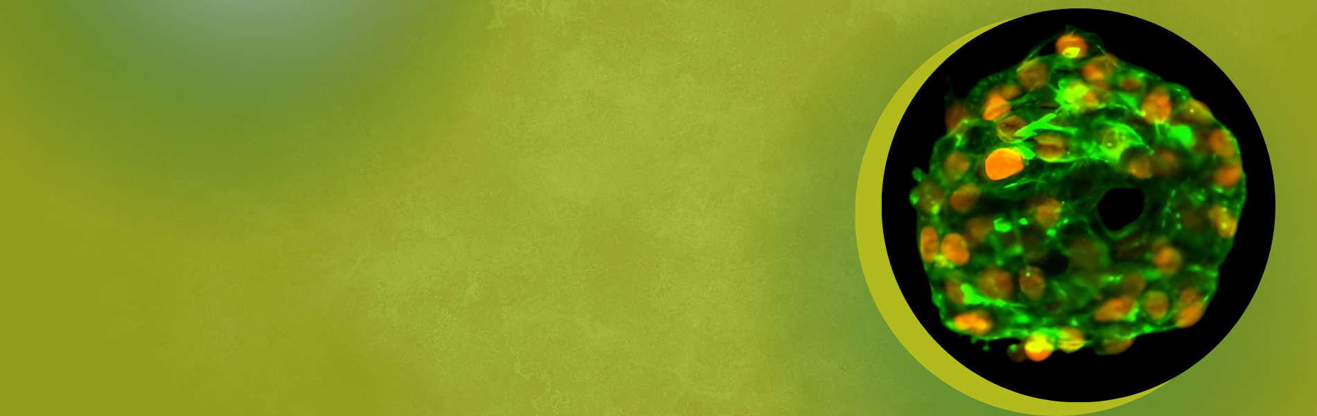 Thyroid Hormone Disruption Webinar Graphic