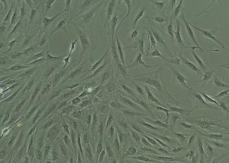 brightfield image of human hepatic stellate cells, passage zero, at 11 days post plating, 100X