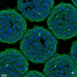  Protocol - Spheroid Image