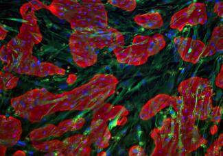 TruVivo All-human 2D+ hepatic system
